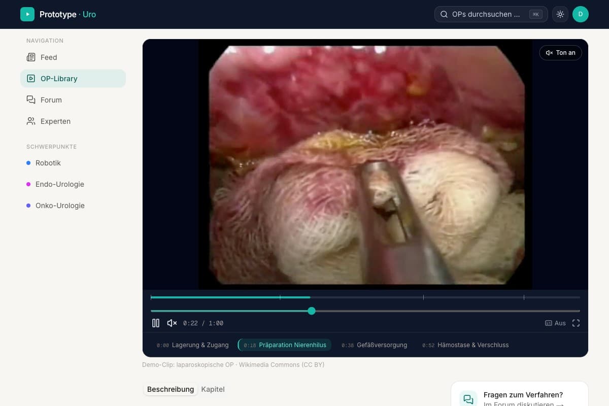 OP-Video-Player mit Kapitel-Markern und Untertiteln